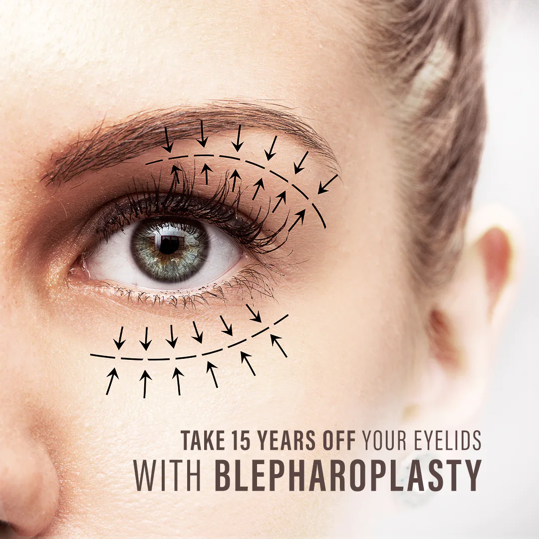 Social media for plastic surgery feed presentation