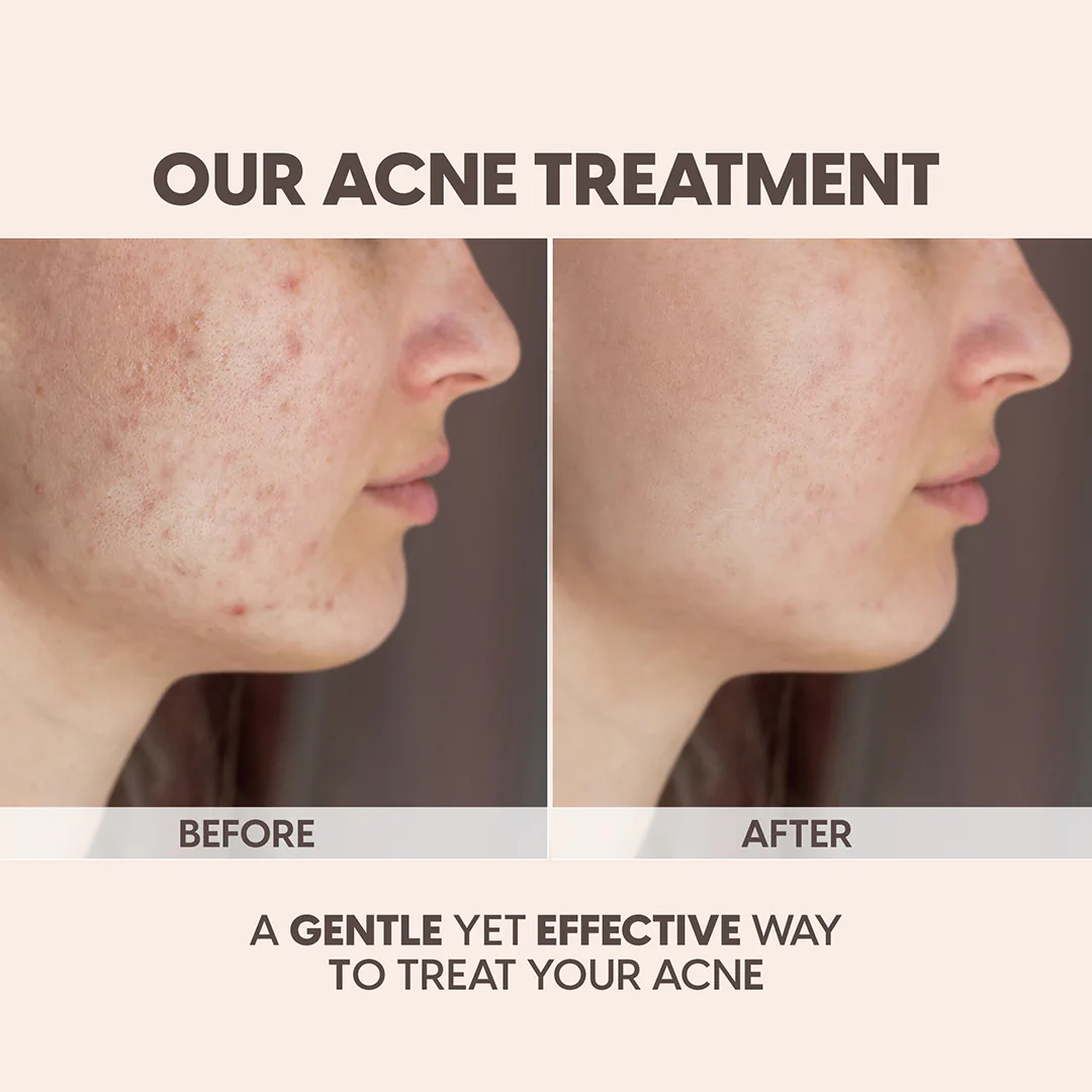 social media for med spa feed presentation