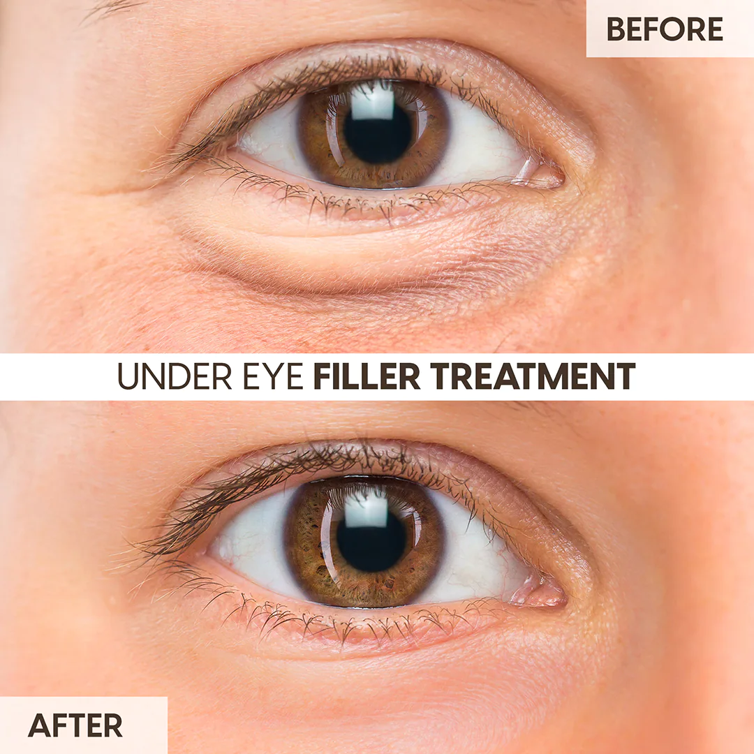 social media for med spa feed presentation